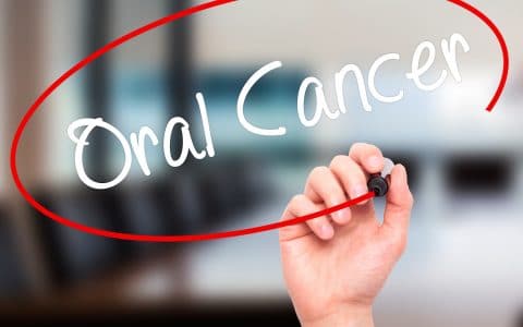 When Was Your Last Oral Cancer Screening?