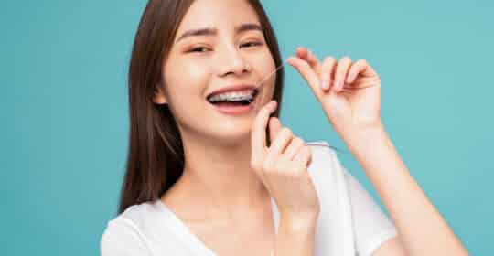 Be Sure to take Care of Your Teeth While Wearing Braces