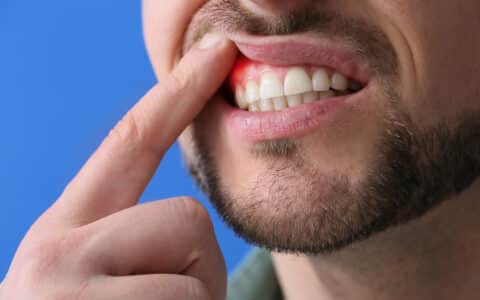Beat Gum Disease with These Tips for Healthy Gums
