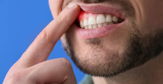 Beat Gum Disease with These Tips for Healthy Gums