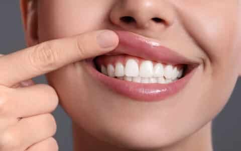 Do you Have Gum Disease? What are the Signs to Watch For?