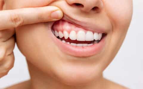 Gum Health Matters: Signs You Shouldn’t Ignore