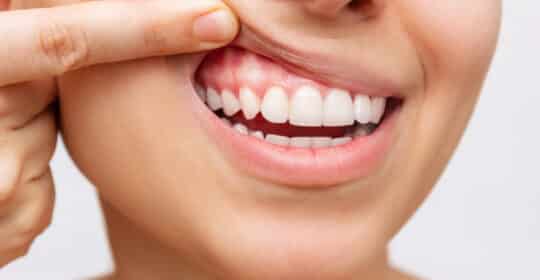 Gum Health Matters: Signs You Shouldn’t Ignore