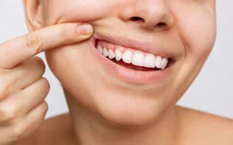 How Are Your Gums? It’s National Gum Care Month!