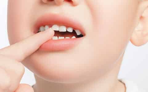 My Child’s Baby Teeth Are Coming in Crooked