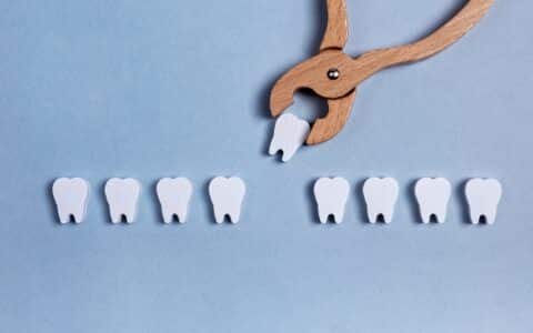 Should I Pull My Tooth or Have it Restored?