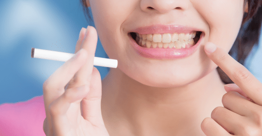 How Does Smoking and Tobacco Affect Your Teeth?