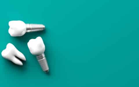 Summer Is a Great Time to Replace Missing Teeth