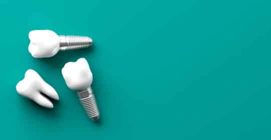 Summer Is a Great Time to Replace Missing Teeth
