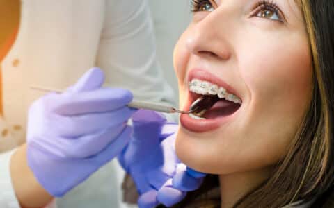 Taking Care of Your Teeth While You Wear Braces