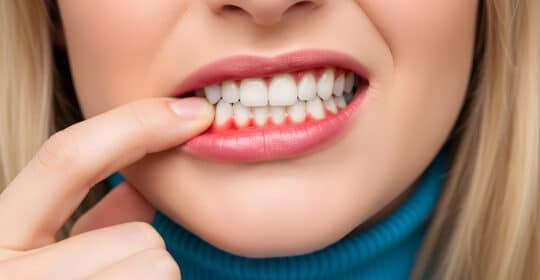 Understanding Gum Disease and Why Early Treatment Matters