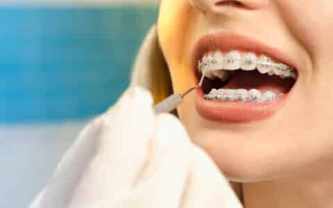 Which Orthodontic Treatment is Best for You? 